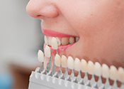 Implant Dentistry (dental implants) at Southern Dental Associates, Houston TX.