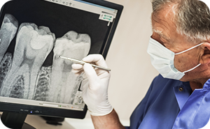 Surgical Tooth Extractions.